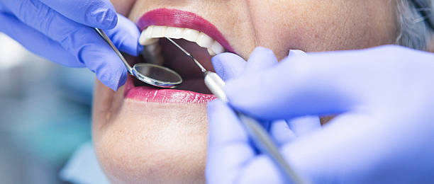 Best Emergency Root Canal Treatment in Henry, IL